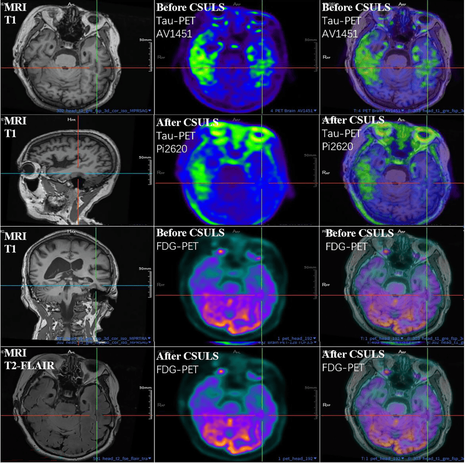 300多家医院抢着做的手术<strong></p>
<p>艾达币交易平台</strong>,为何突被禁?