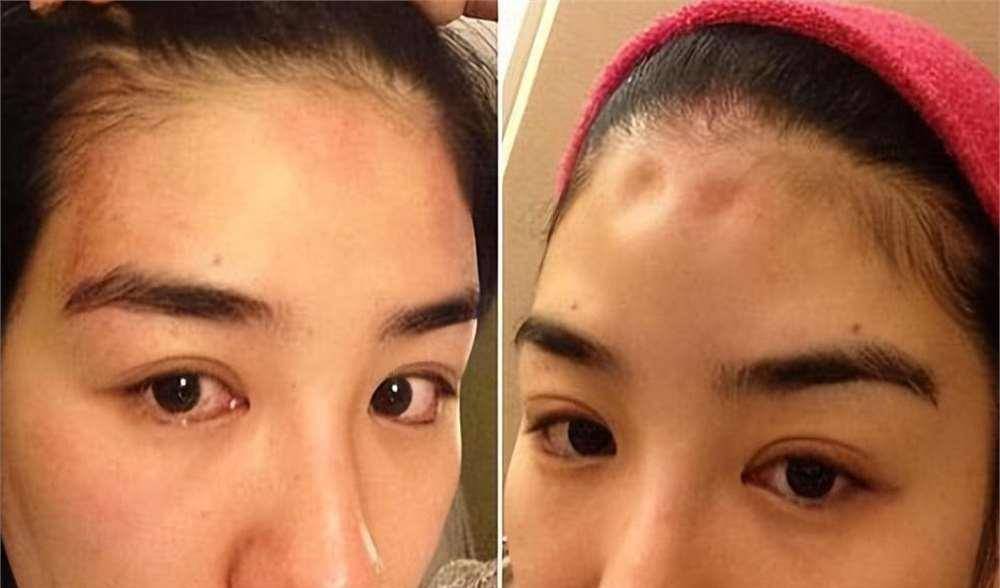 罗霖被家暴17年<strong></p>
<p>BCH交易平台</strong>,蓝洁瑛遭性侵暴力还被围观!女明星的暴力事件还有很多