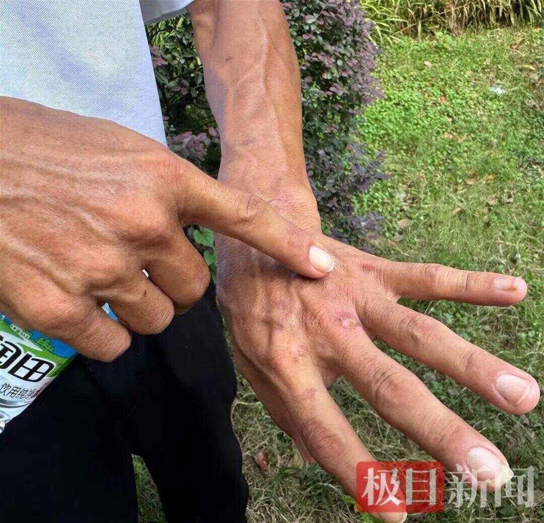 生意爆火赚得盆满钵满<strong></p>
<p>LTC交易平台</strong>?鸡排哥谈收入笑称“还没赚到1个亿”