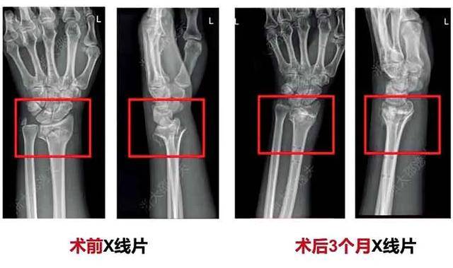 世界性难题<strong></p>
<p>莱特币交易平台</strong>，攻克了？