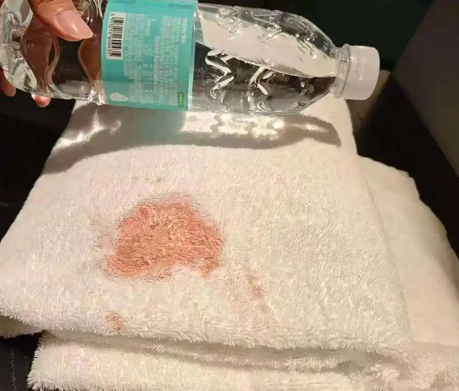 希岸酒店浴巾上出现大片血迹<strong></p>
<p>IPFS交易平台</strong>,到底是谁的责任?