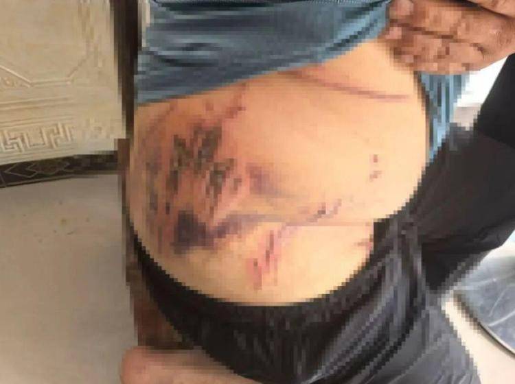 湖北鹤峰县疑再现老虎踪迹<strong></p>
<p>火币交易官网</strong>，村民家猪遭袭，玉米地发现脚印，此前男子自称干农活时被抓伤，当地回应