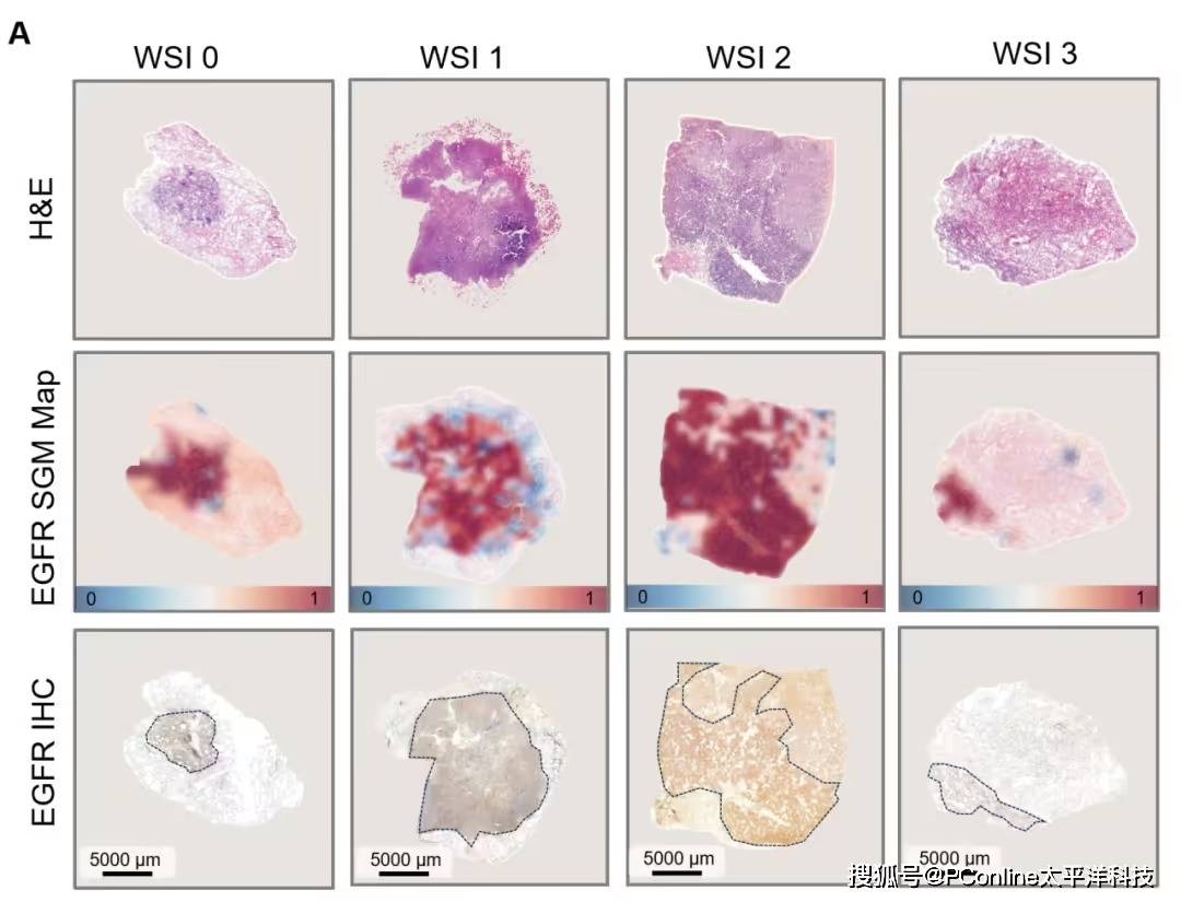 准确率高达 99%<strong></p>
<p>抹茶交易官网</strong>！腾讯 AI 可预测肺癌基因突变